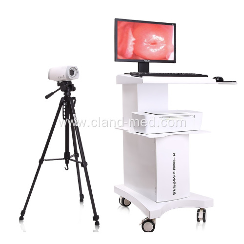 Medical Digital Portable Video Colposcope for Gynecology